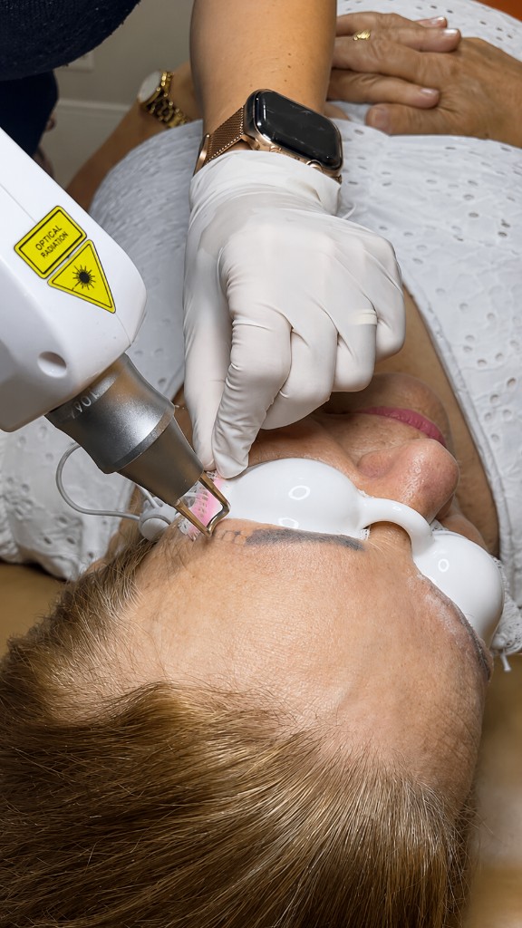 Remoção de micropigmentação e tatuagem