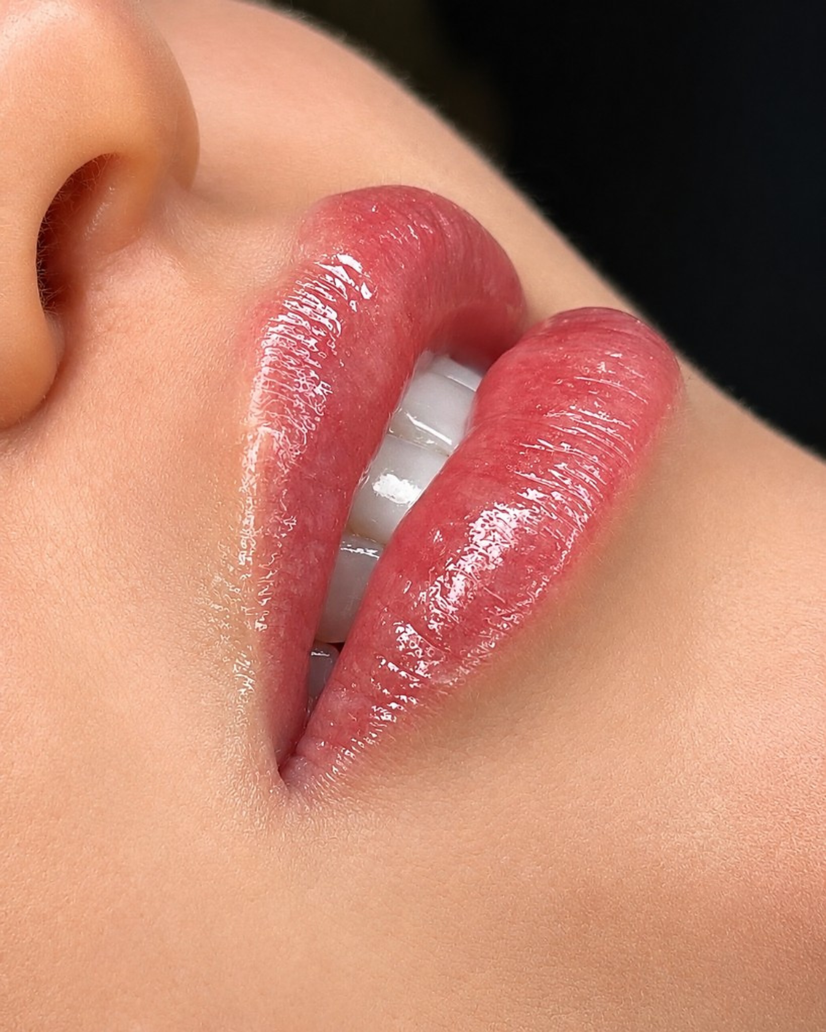 Hidragloss